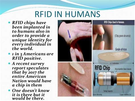 rfid chips wrong site surgery|Bilateral Implanted Radiofrequency Identification Chips .